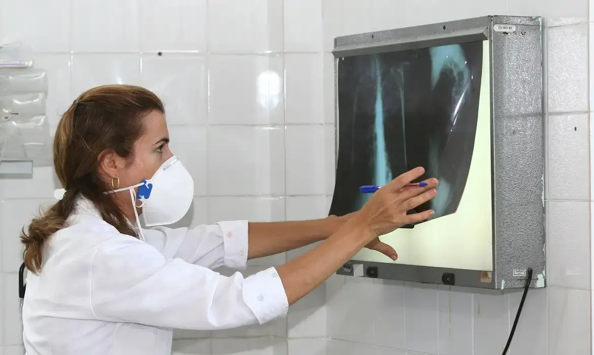 Casos de tuberculose disparam em Cururupu e acendem alerta na população