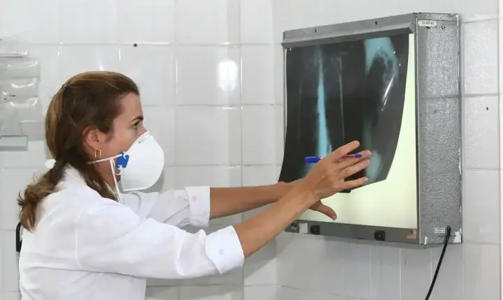 Casos de tuberculose disparam em Cururupu e acendem alerta na população